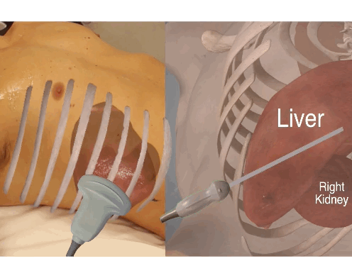 EEU case image missing